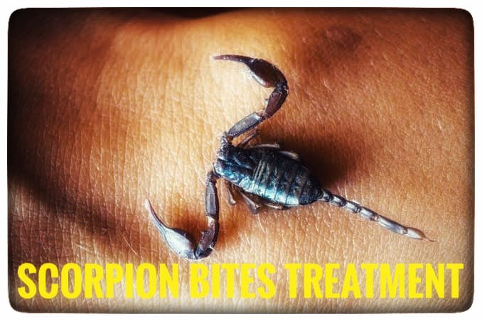 SCORPION BITE DESHI TREATMENT 