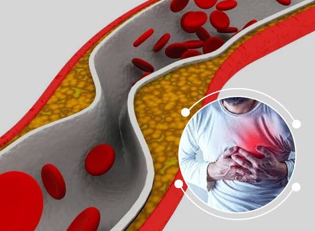 Cholesterol