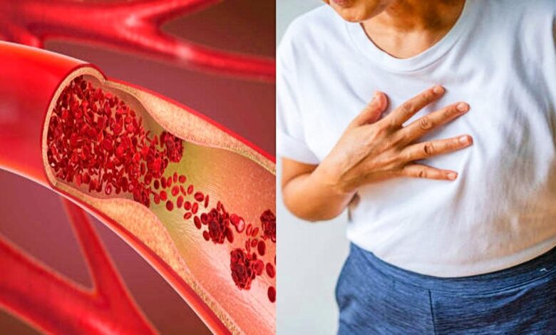 heart disease