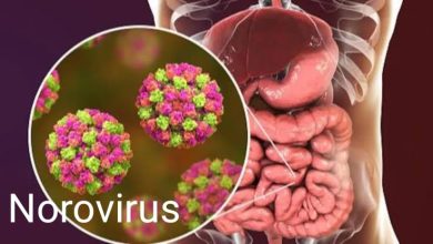 Norovirus