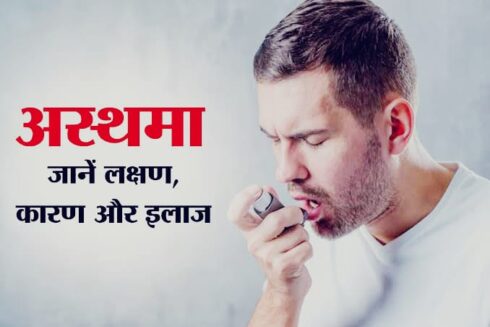 Asthma Treatment