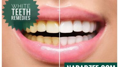 White Teeth Remedies